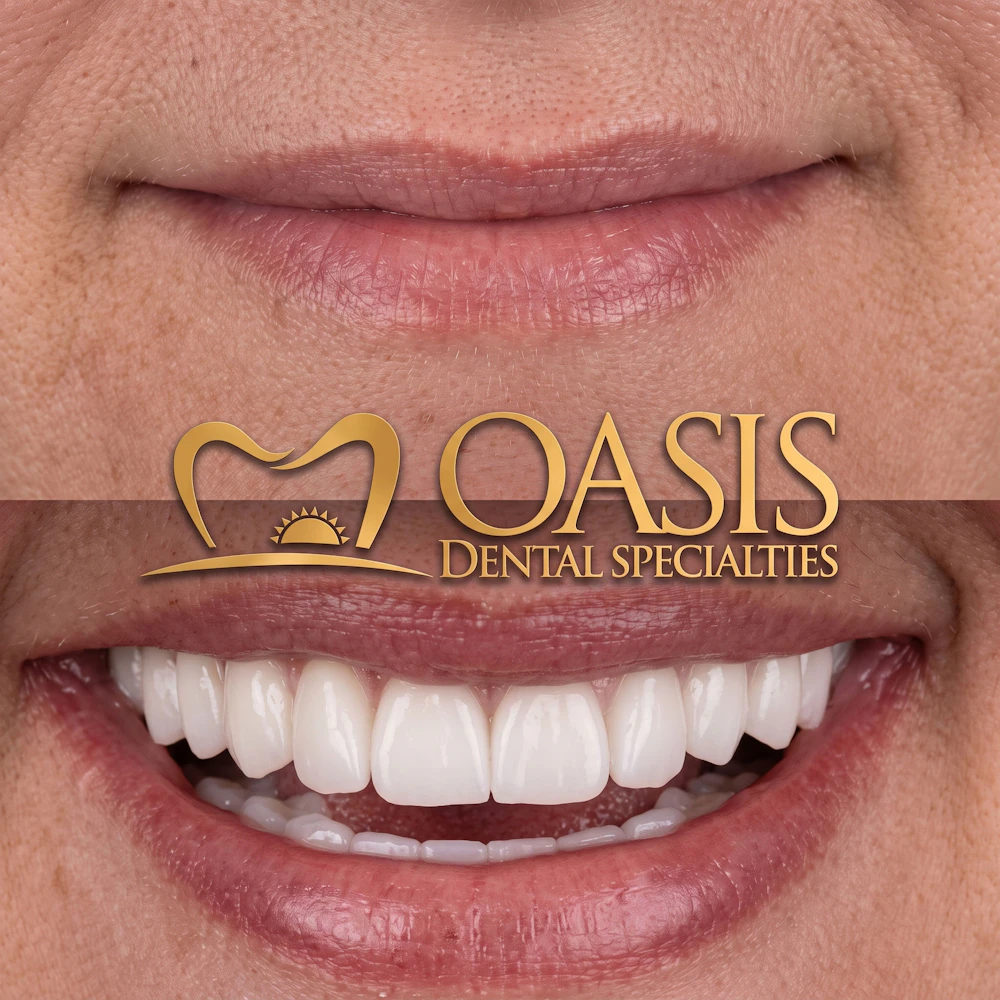 Before and After patient at Oasis Dental Specialties