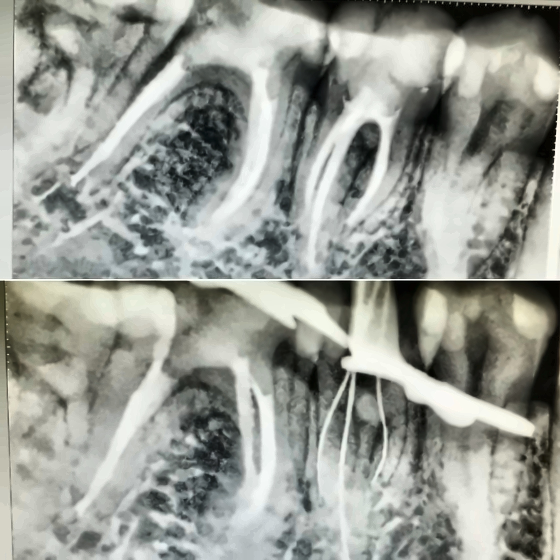 Xray