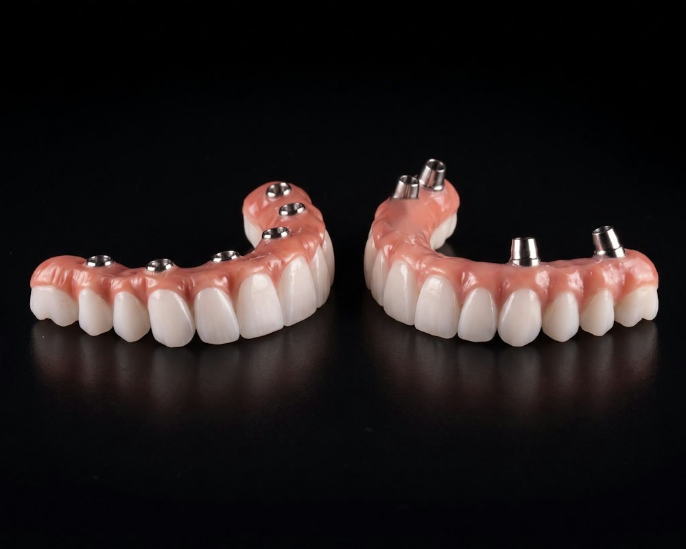 Upper and lower All-on-6 full-arch dentures with implant connectors