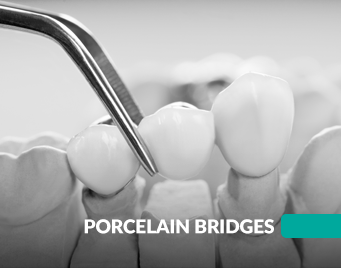 Porcelain Bridges