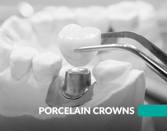 Porcelain Crowns