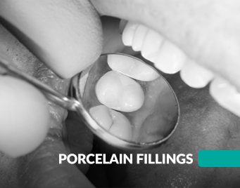 porcelain fillings