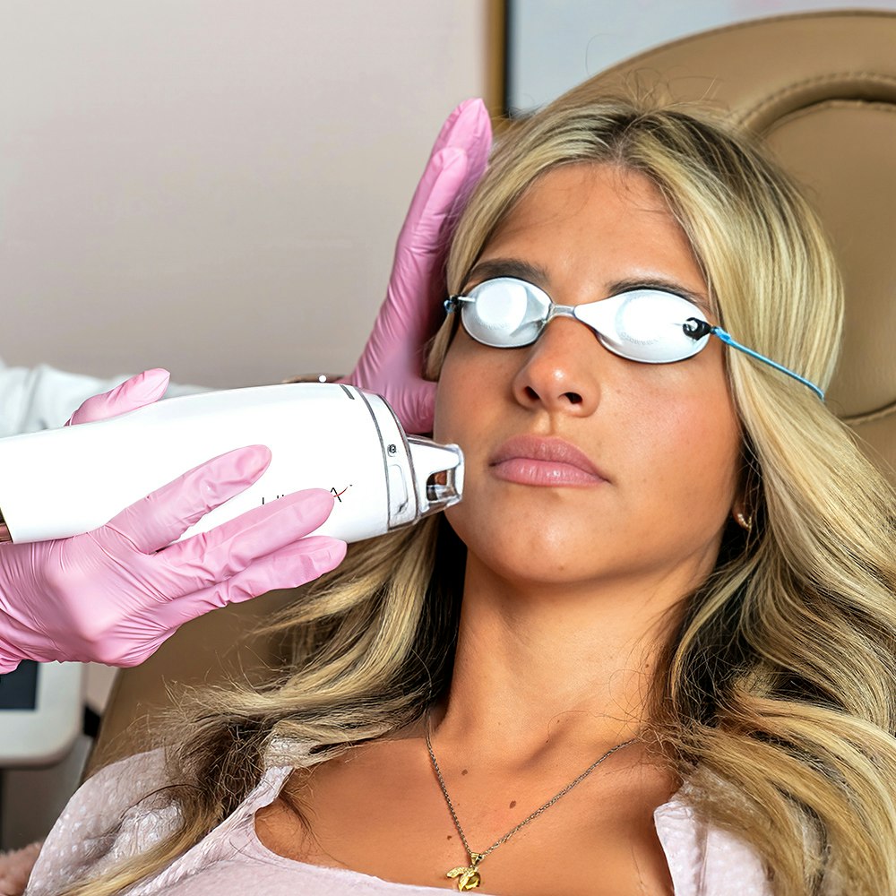 Nichole with a laser resurfacing patient