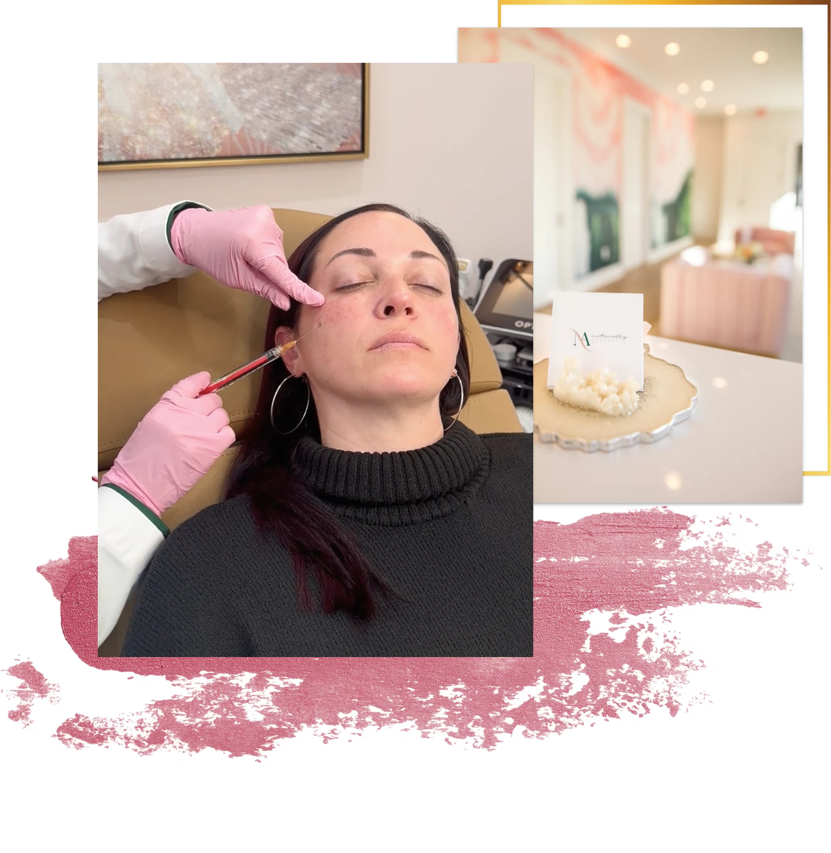 collage of real injectables patient photo and business cards in office