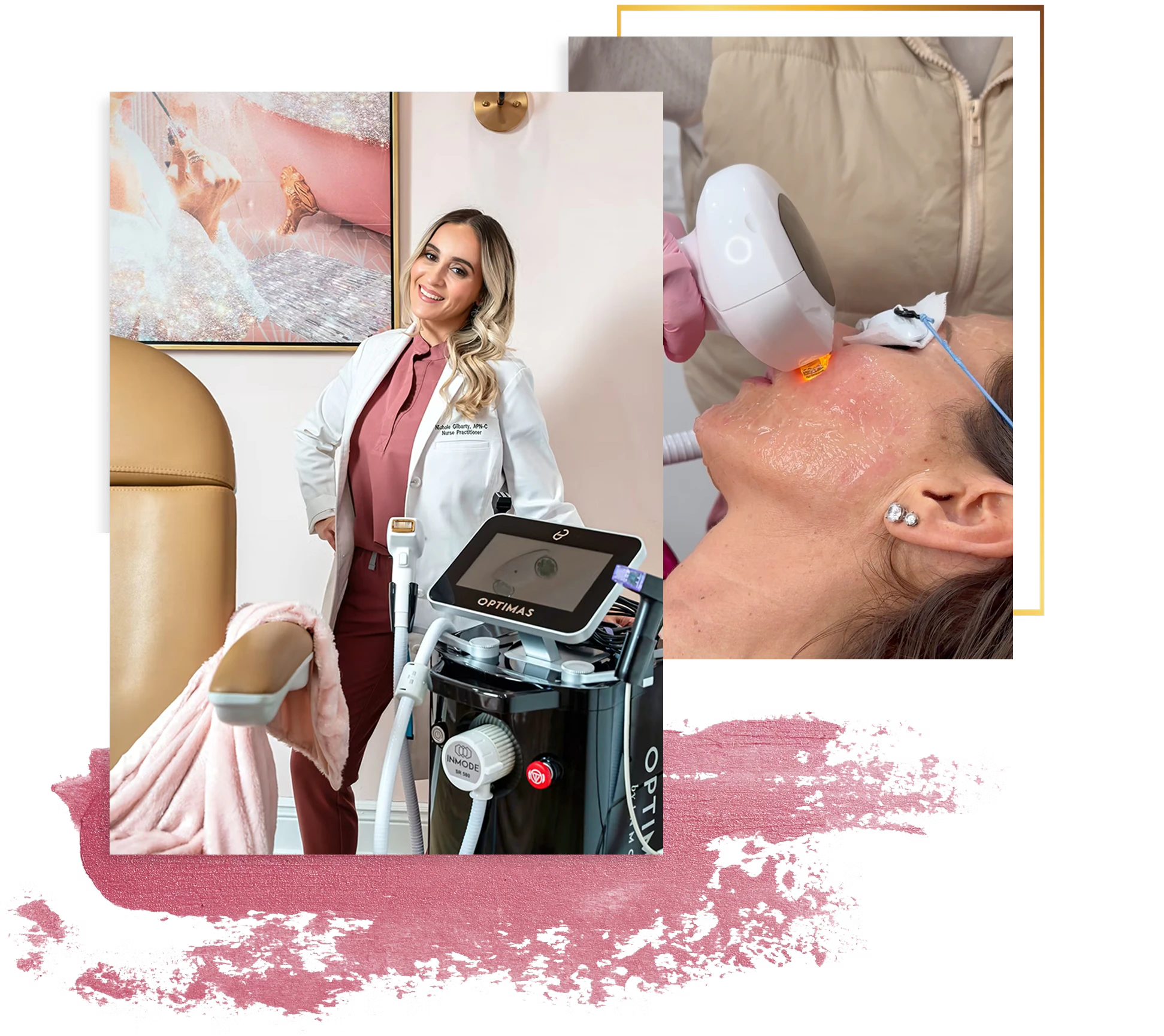 Nichole Gilbarty Nurse Practitioner posing with OPTIMAS INMODE machine. another photo of OPTIMAS IPL photofacial in use.