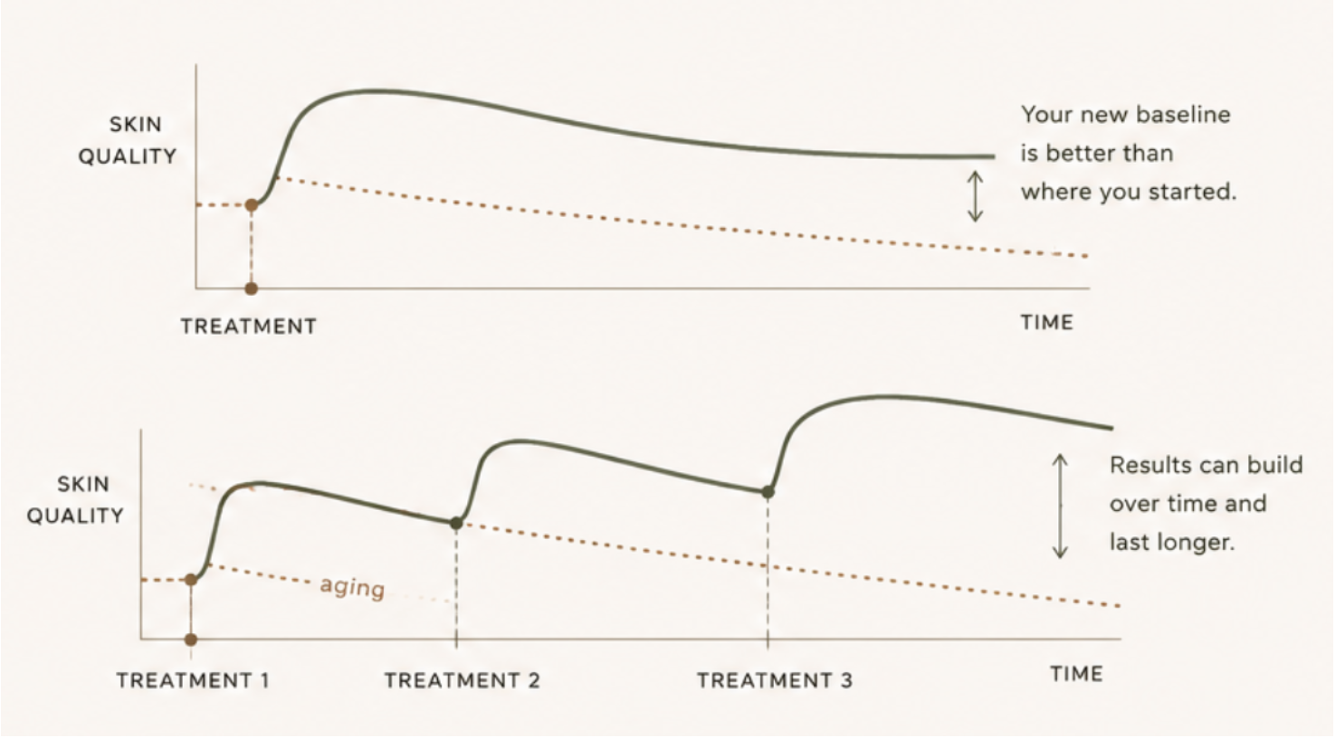 benefits of routine laser resurfacing