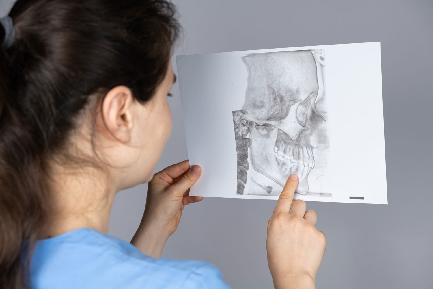 dentist pointing to missing tooth on x-ray