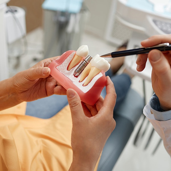 dental implant model