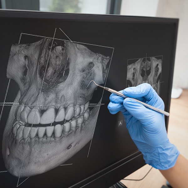 dentist pointing at X-ray with dental tool