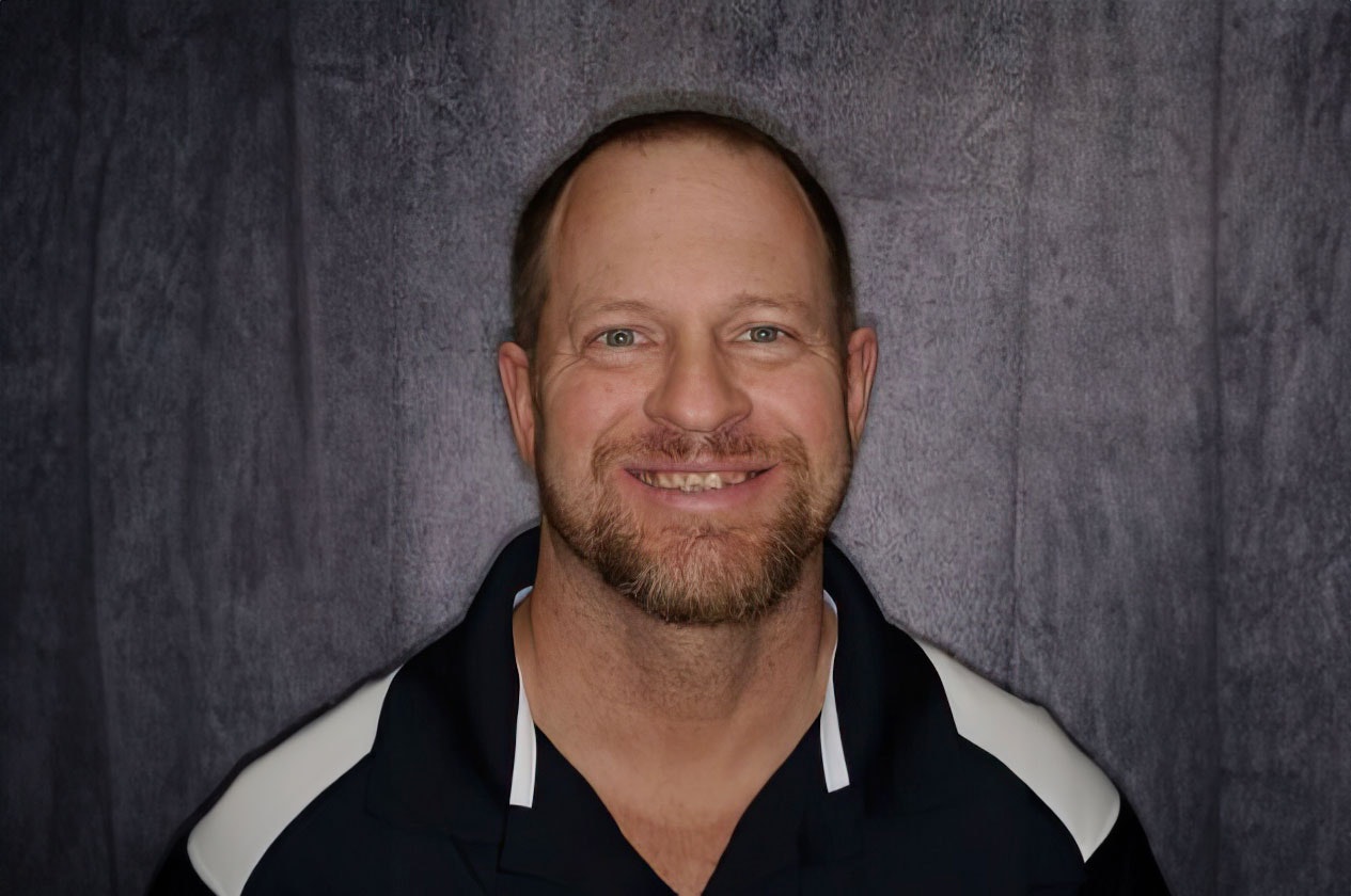 Dr. Lippe's implant patient, Brent, before treatment