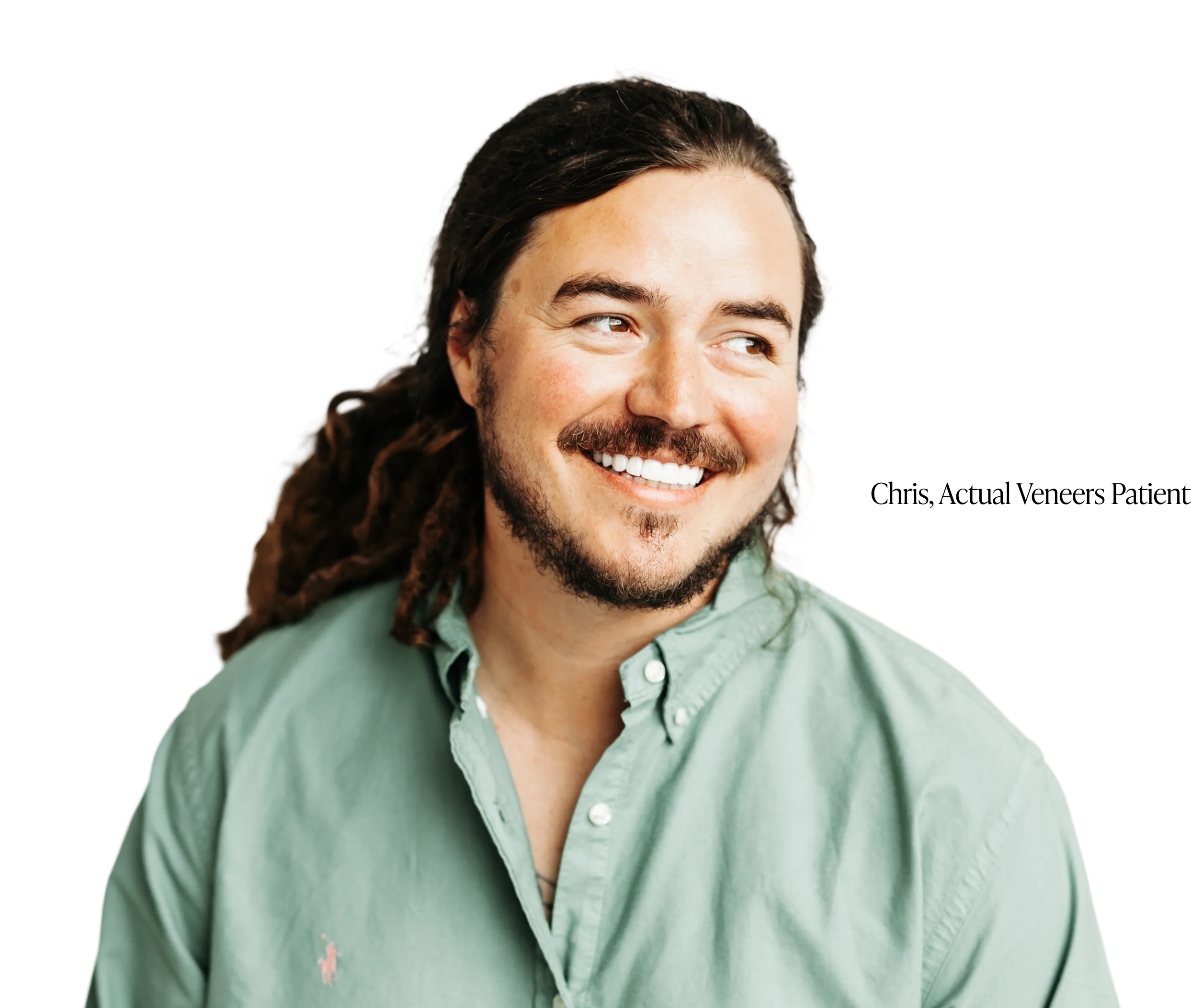 our real veneers patient