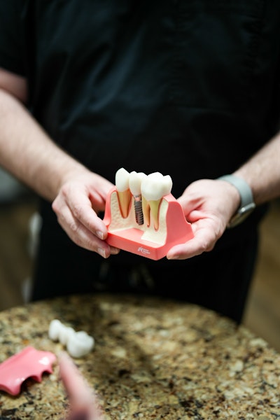 Dental implant model
