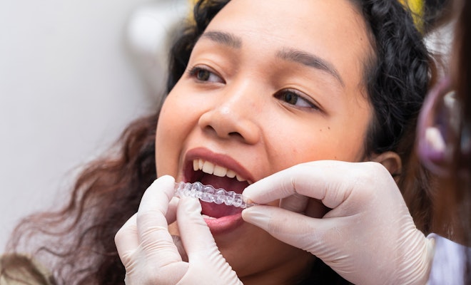 Young girl getting Invisalign placed