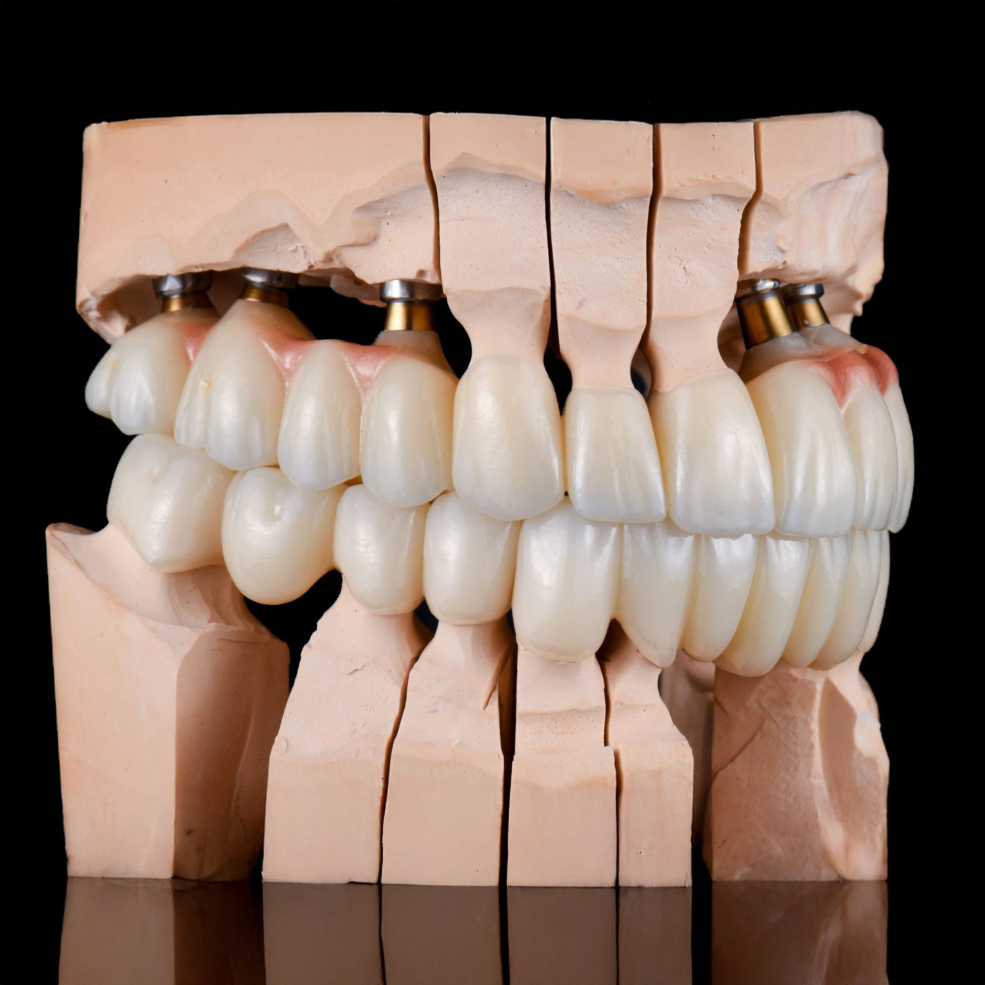 Model of denture set from Montz and Maher Dental Group