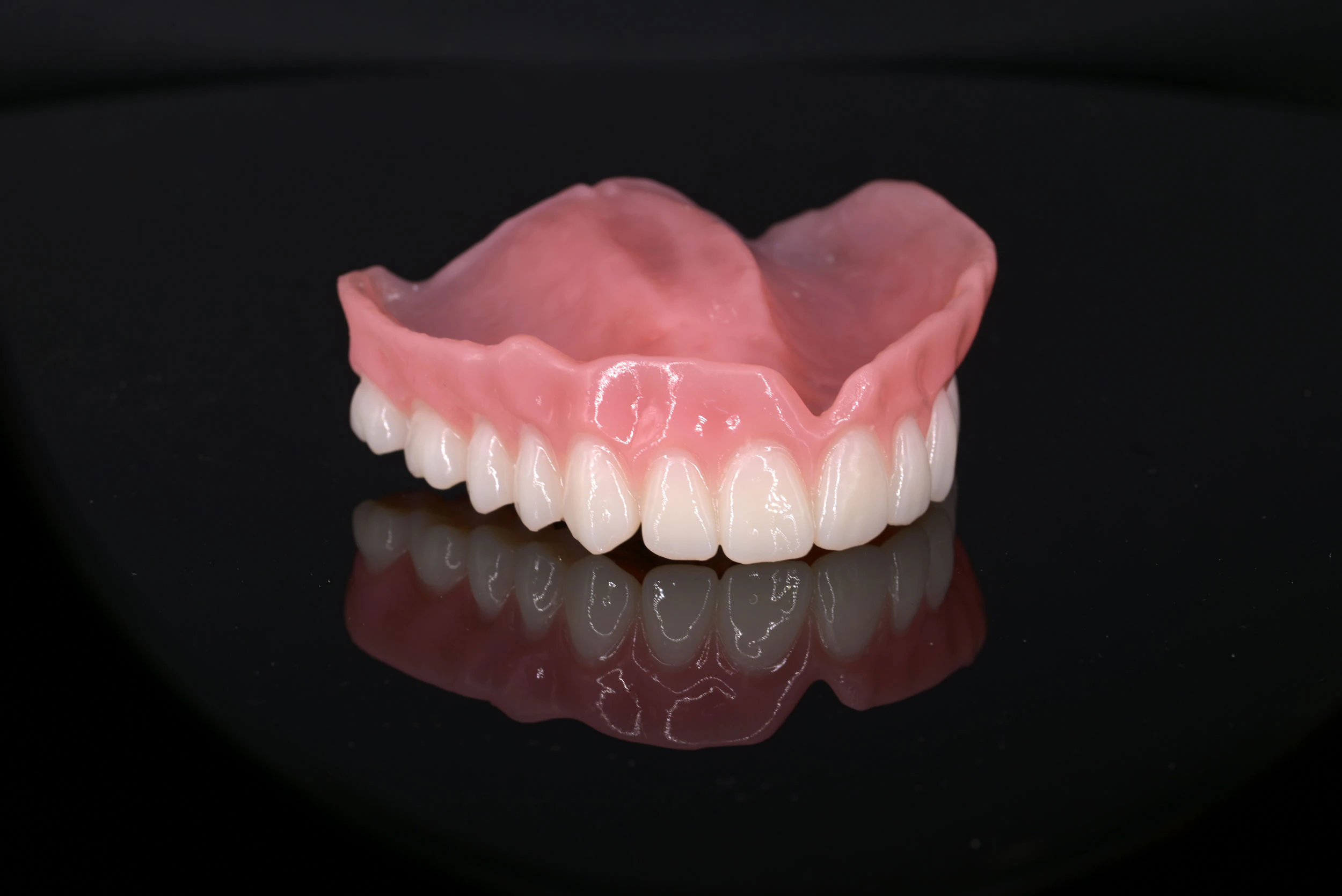 Model of Traditional Dentures at Montz and Maher Dental Group