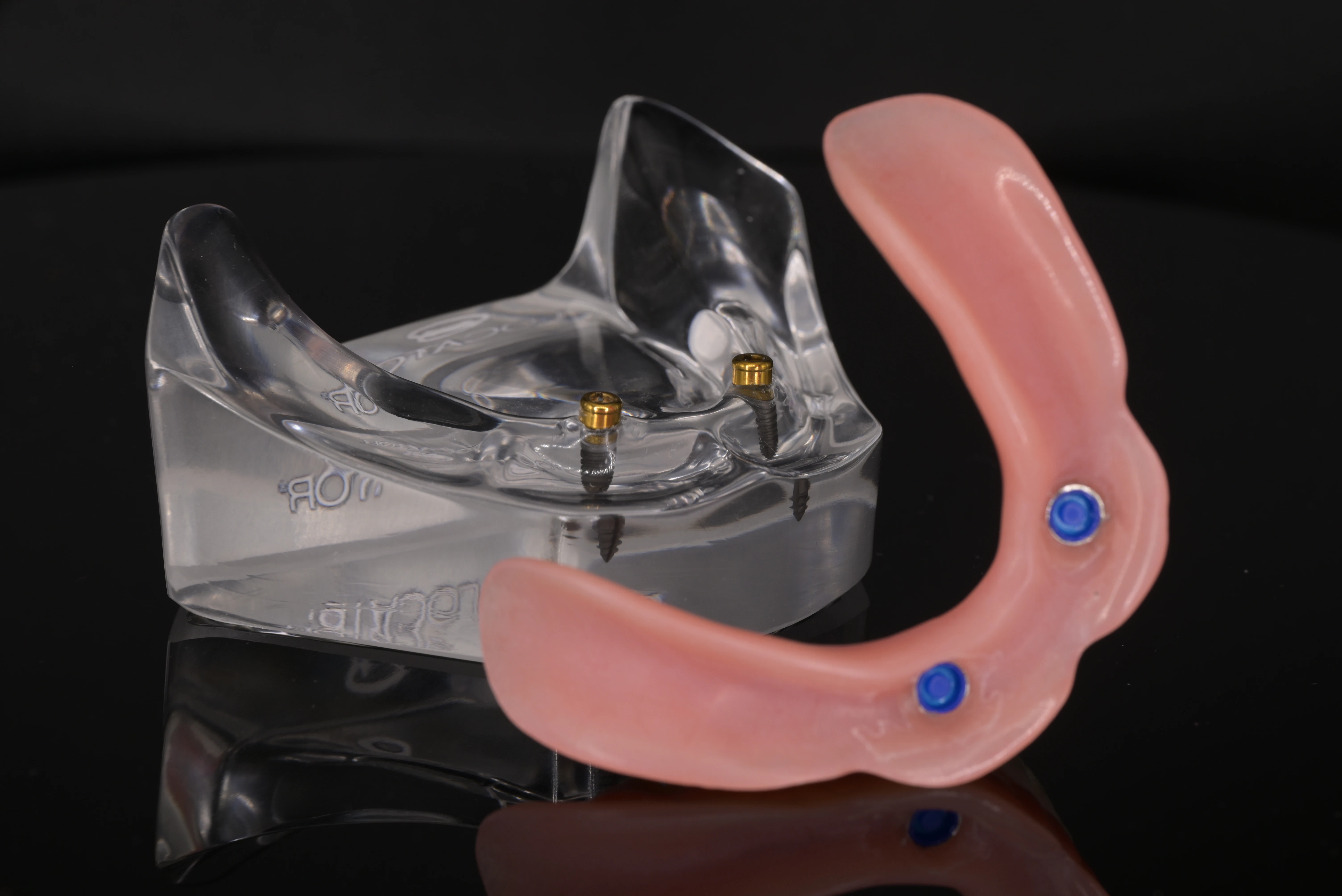 Model of Implant Retained Dentures at Montz and Maher Dental Group