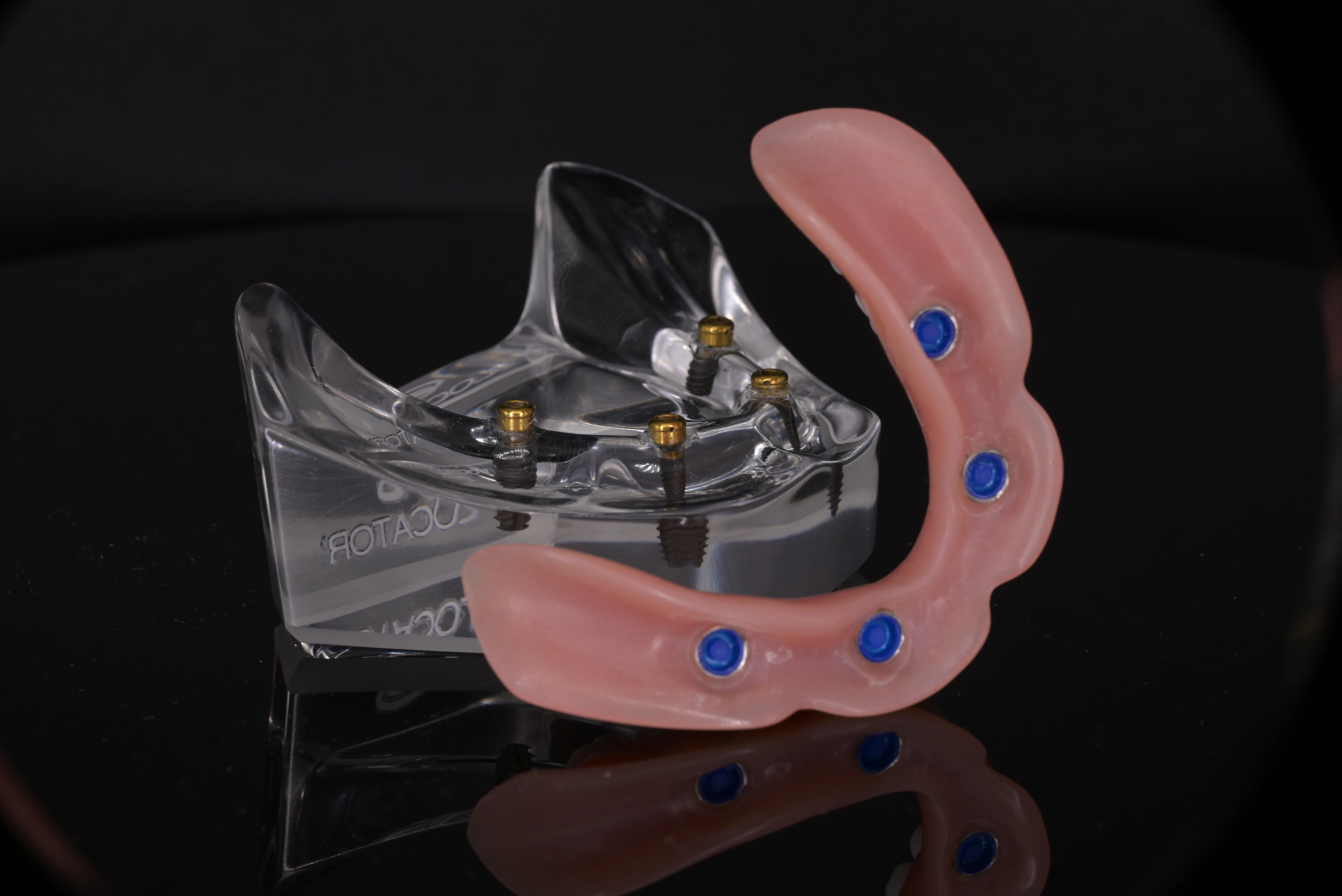 Model of Fixed all-on-4 Dentures at Montz and Maher Dental Group