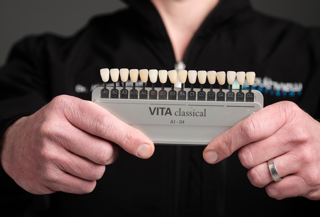 dental shade guide