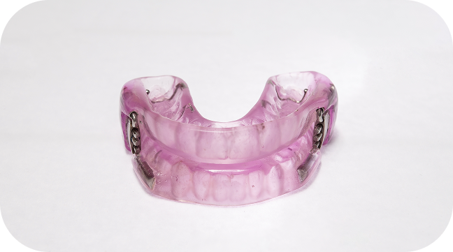 oral appliance front view