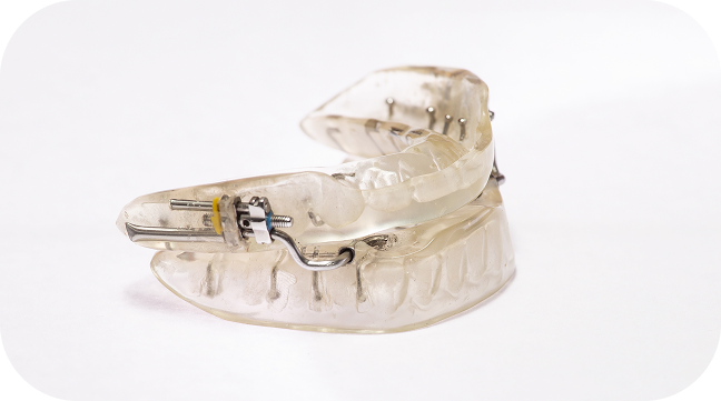 oral appliance