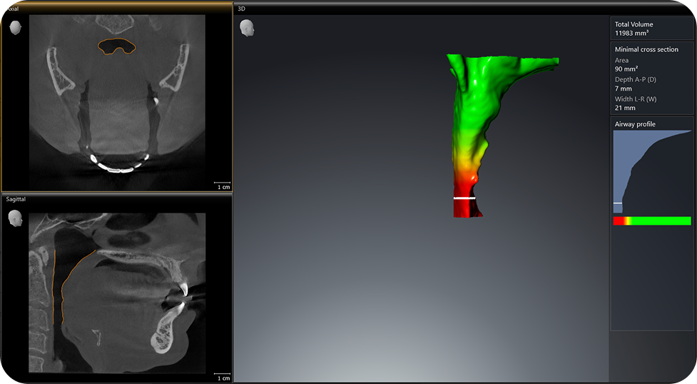 Mouth and throat scan