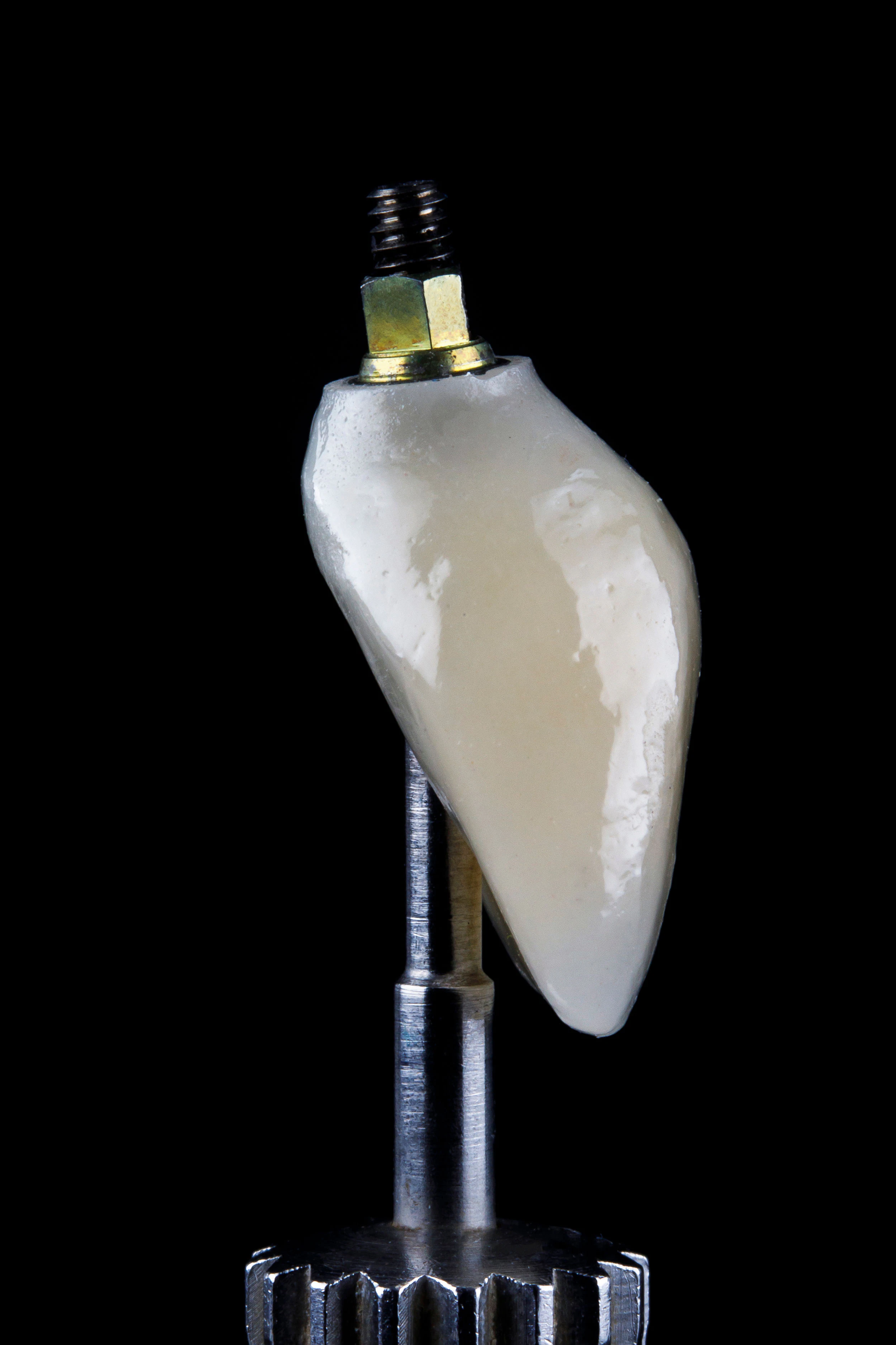 Dental implant