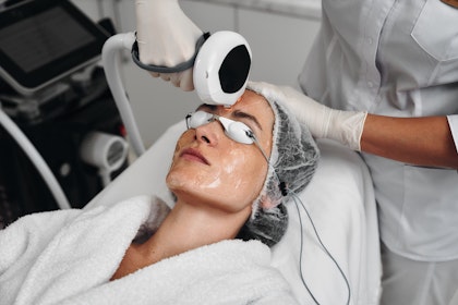 Woman receiving IPL photofacial