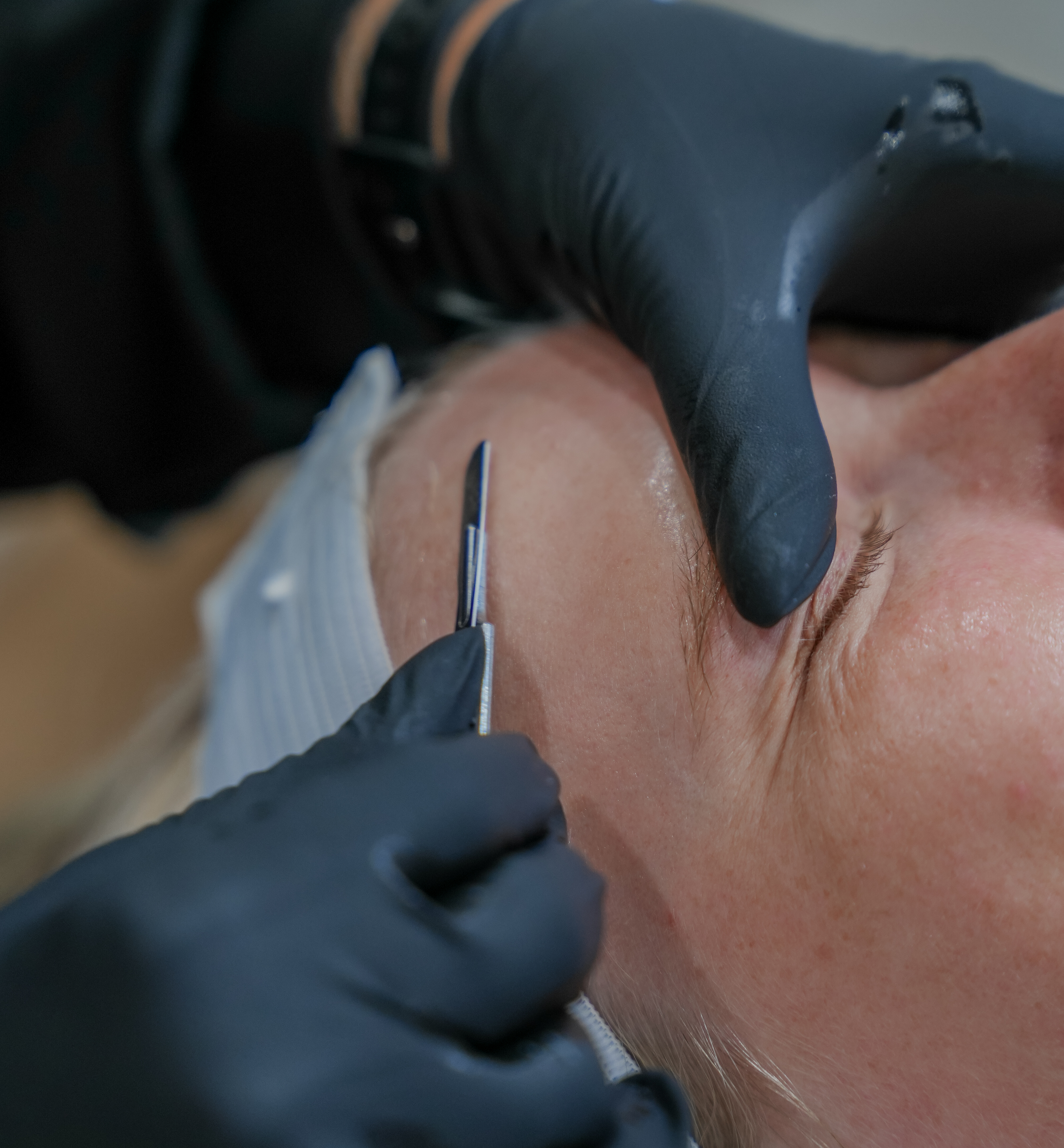 Woman getting a dermaplane facial