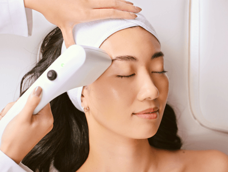 sofwave treatment