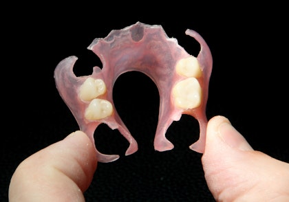 partial dentures