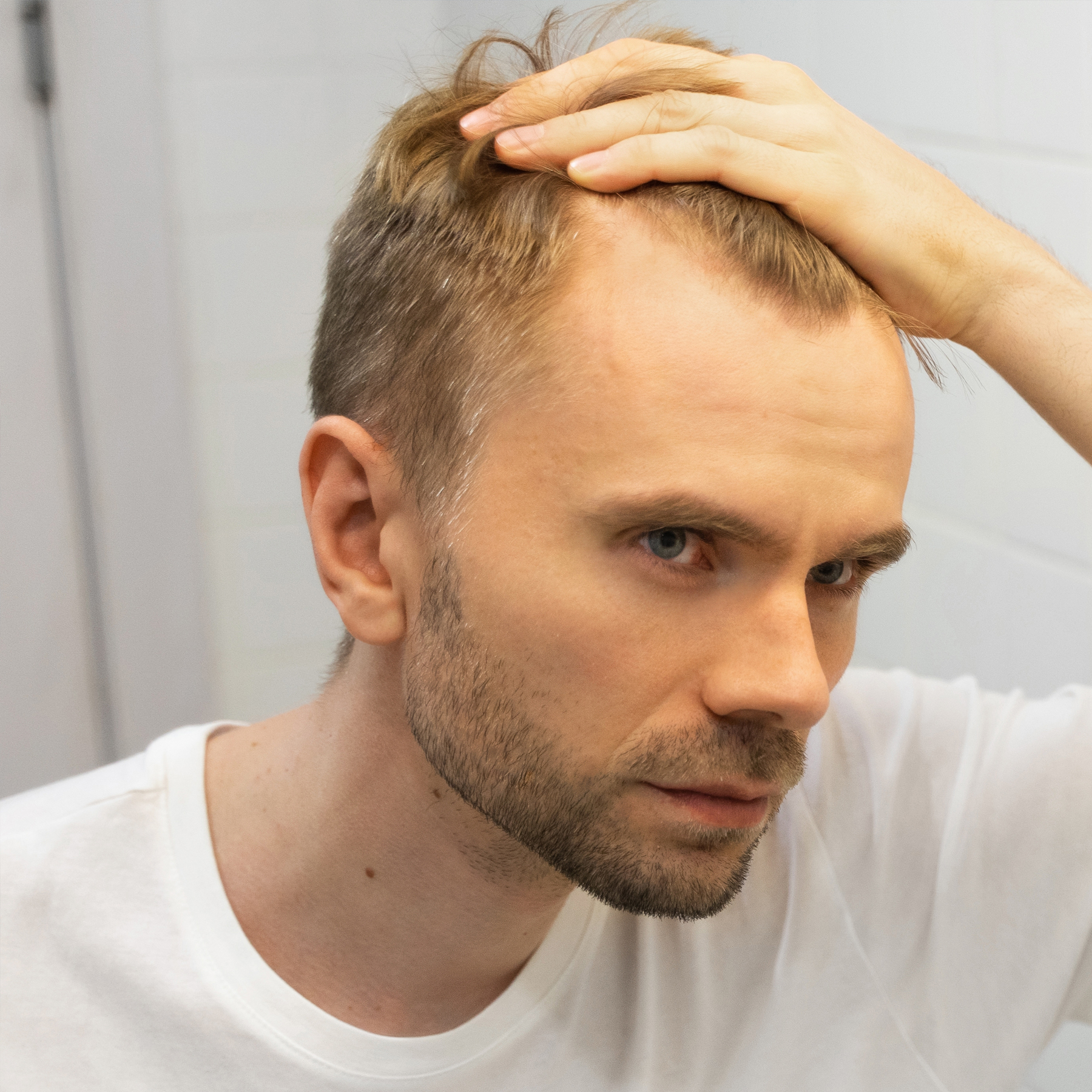 man examining his hairline