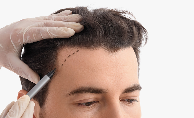 Dr. marking on his head