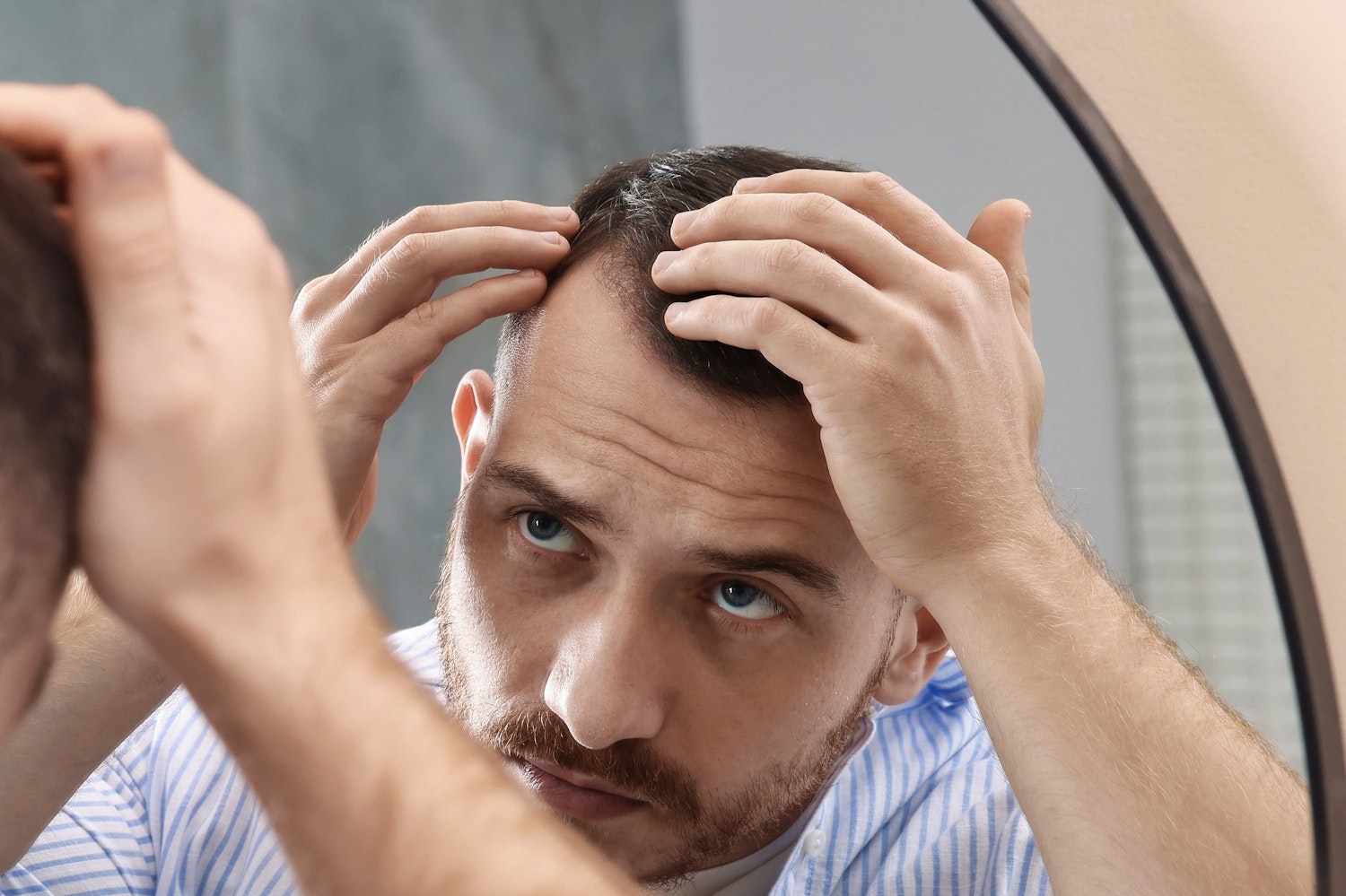 man examining his scalp in the mirror