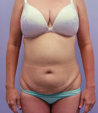 before mom makeover