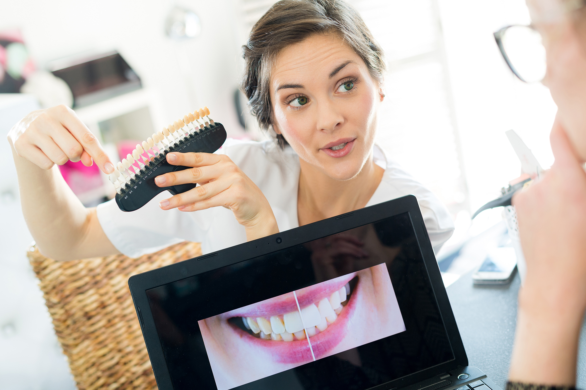 Woman holding a tooth shade guide while showing a teeth whitening comparison on a laptop screen.