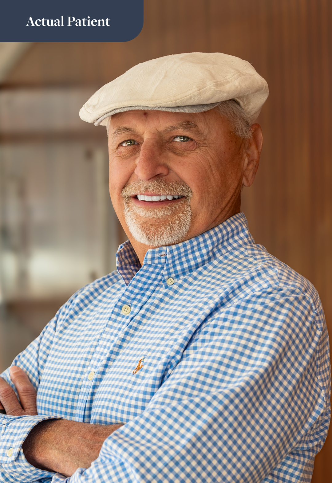 our actual veneers patient