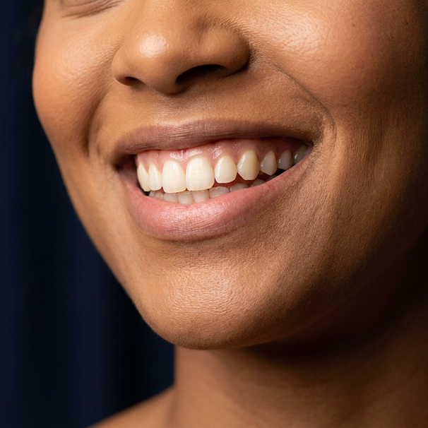 close up of a woman's smile