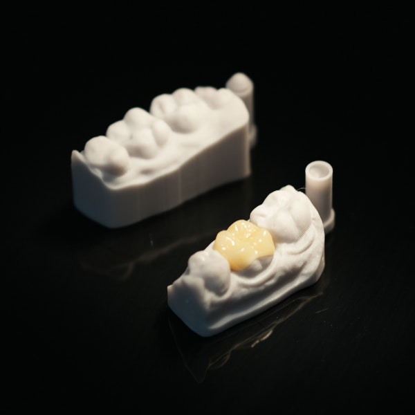 Dental crowns