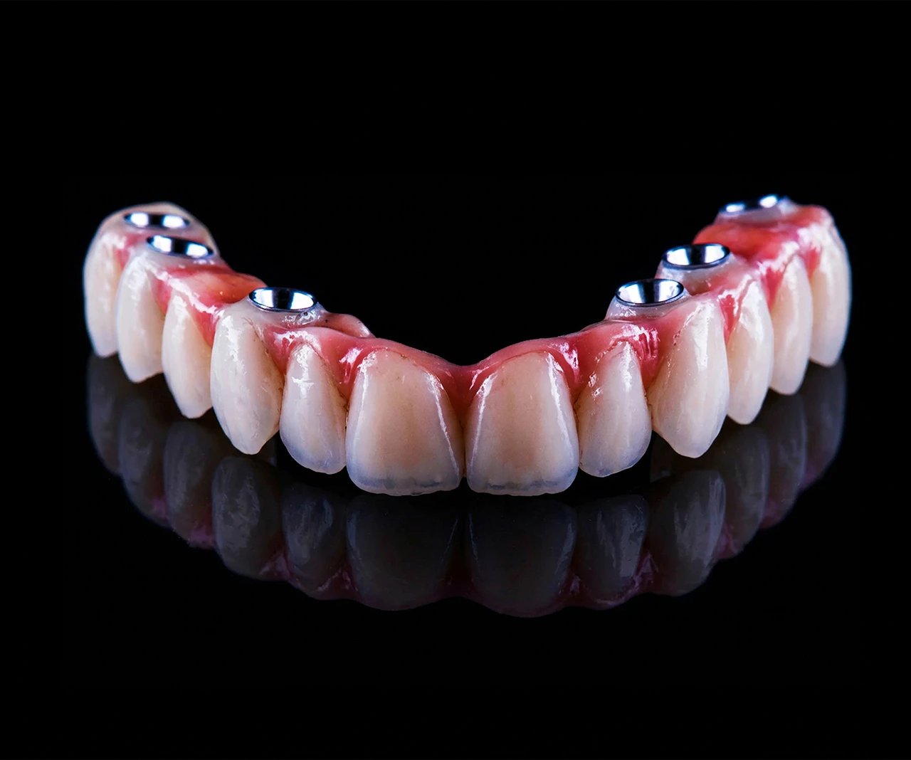 all-on-x denture