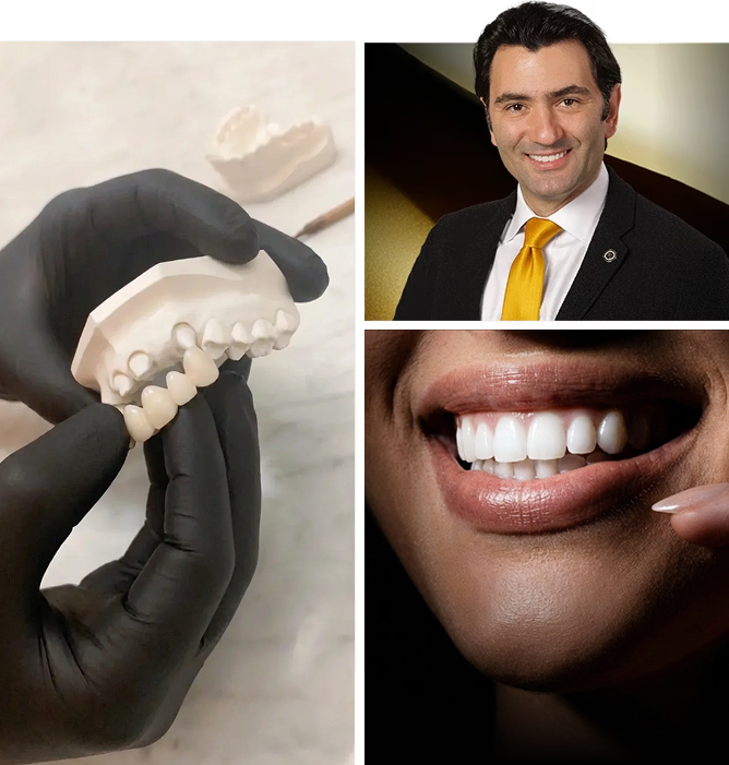 Collage showing a dental model with veneers held by gloved hands, Dr. Shervin Tabeshfar smiling in a suit and yellow tie, and a close-up of a patient’s smile with white, even teeth.