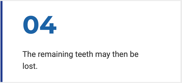 Missing tooth info 4