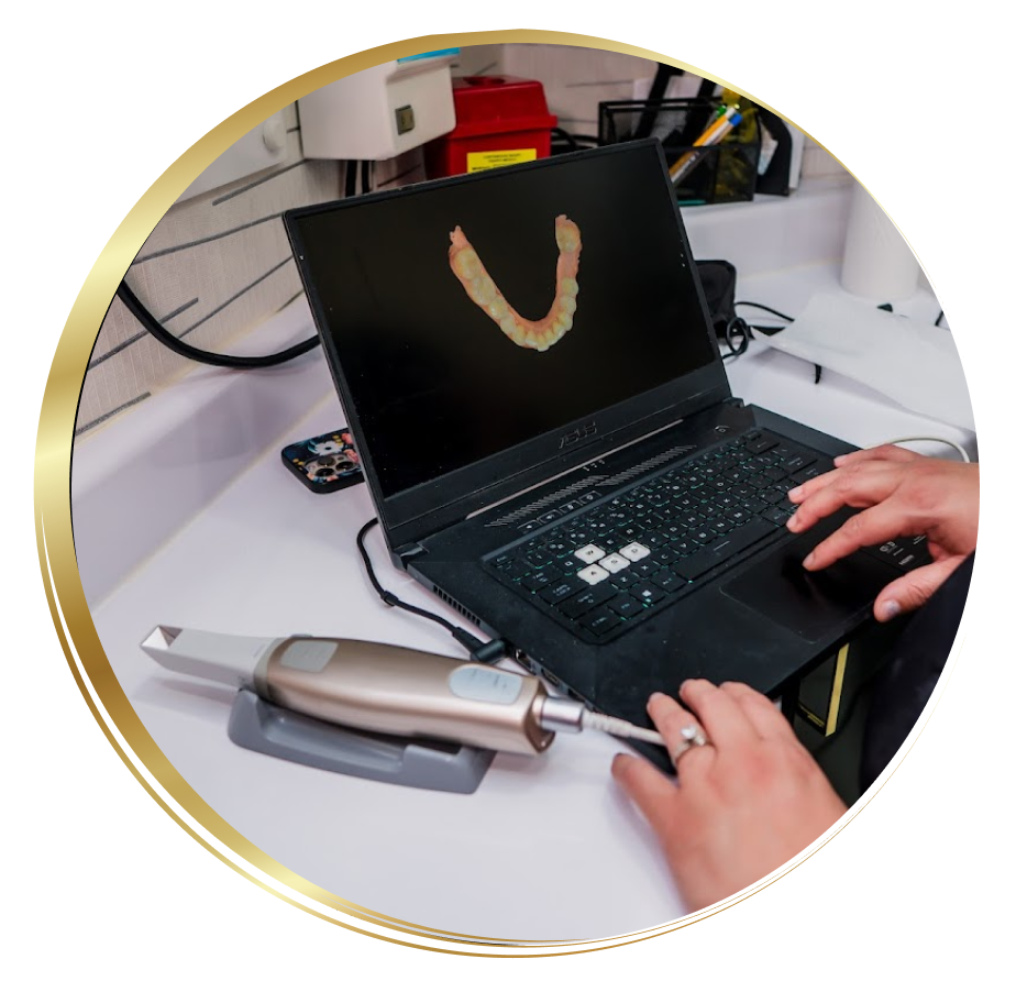 dental arch image on a laptop