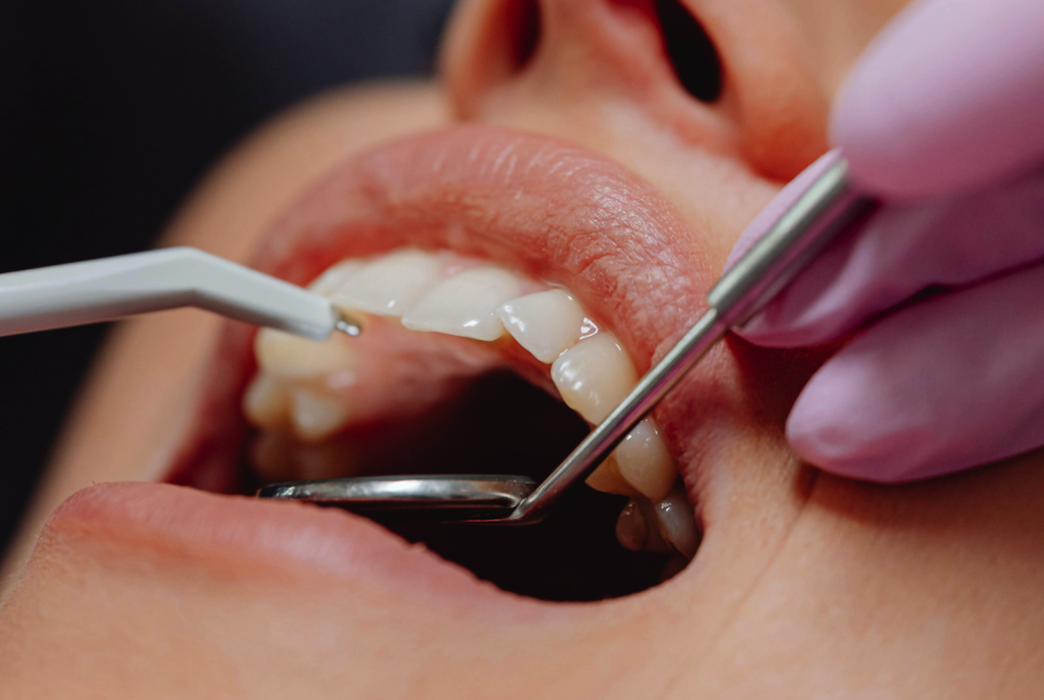 mouth with dental tools