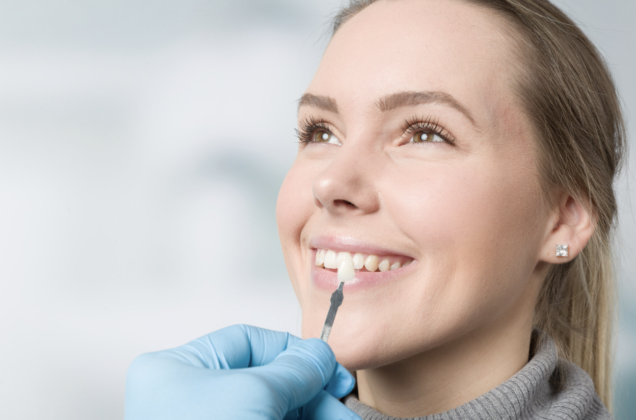 woman getting color matched for crowns