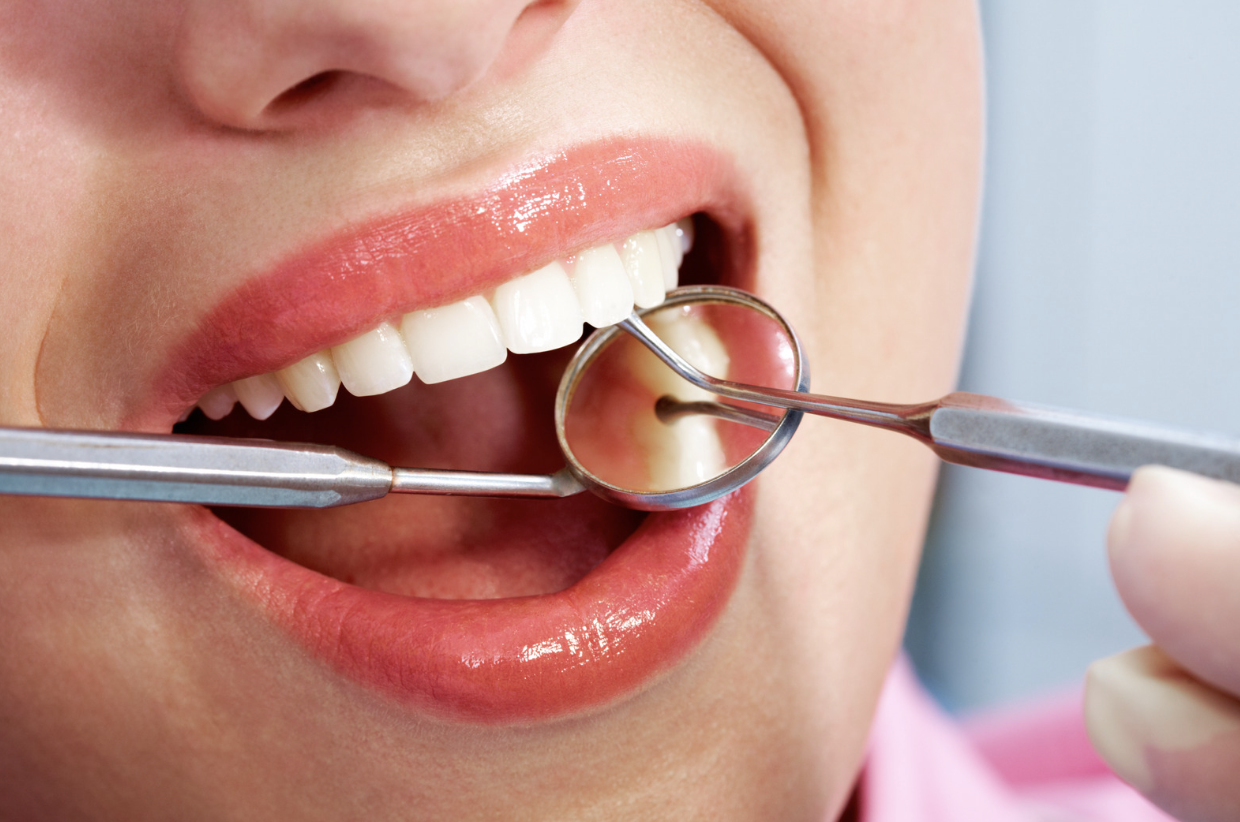 mouth with dental tools