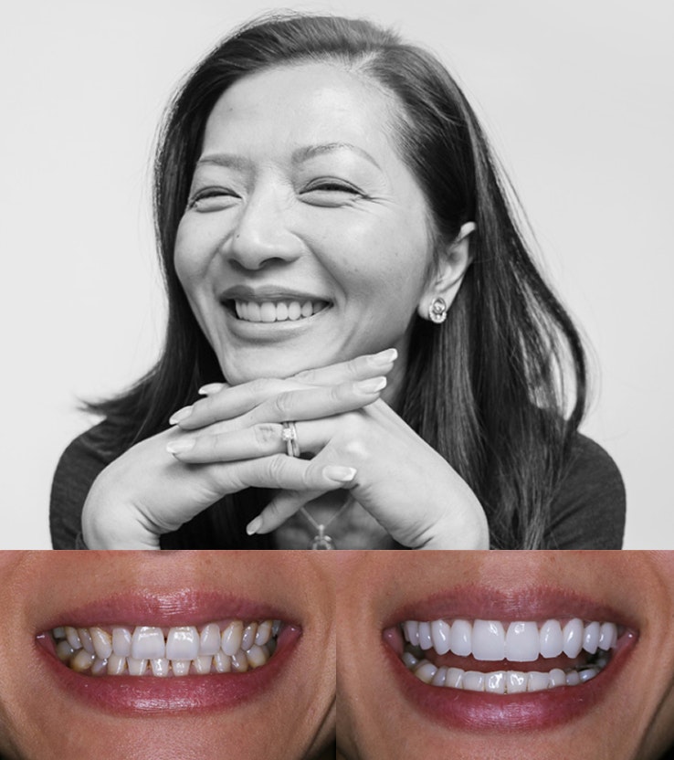 Patient before & after