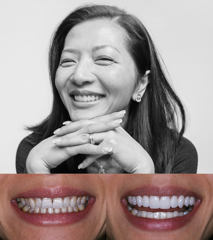 Patient before & after