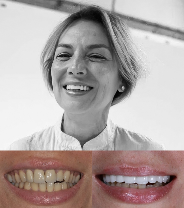 Patient before & after