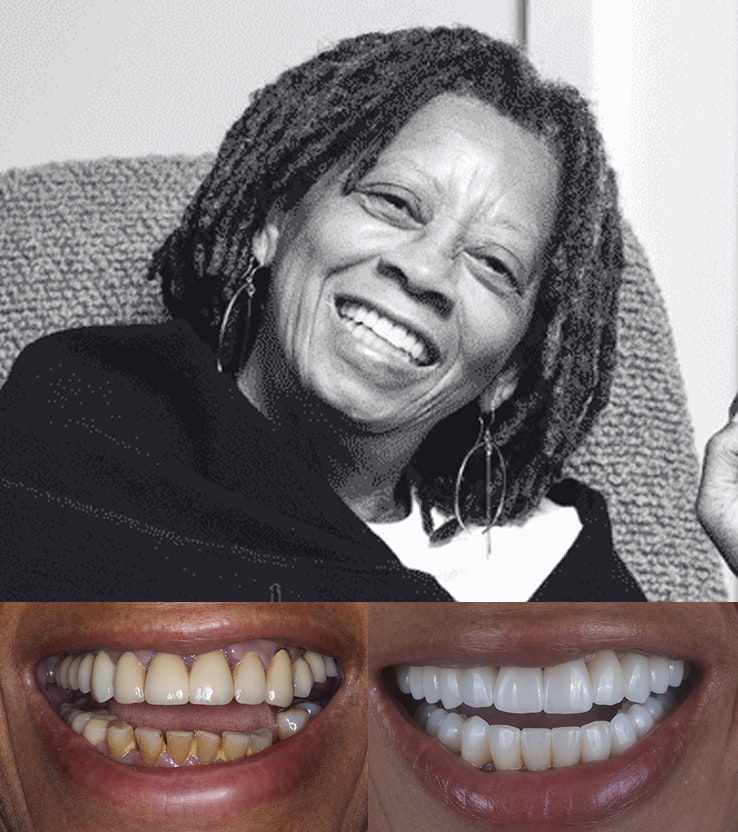 Patient before & after