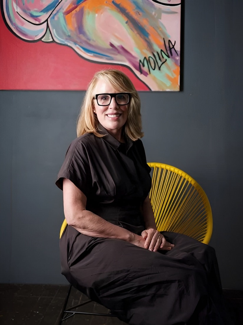 real New York gummy smile patient